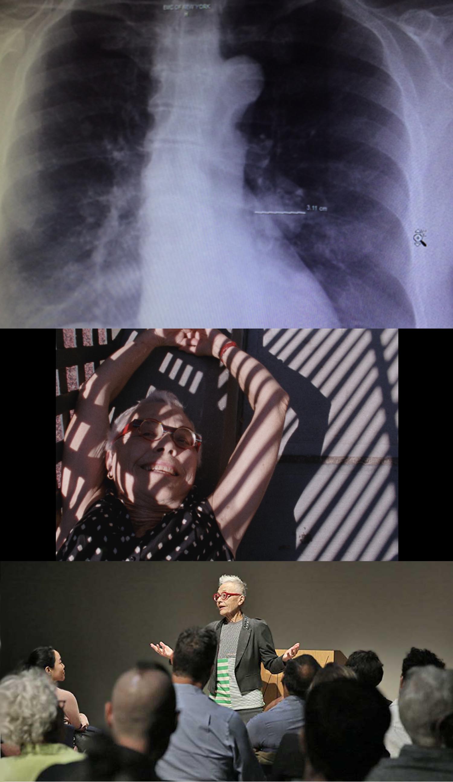 Barbara Hammer fought for the right to medical aid in dying